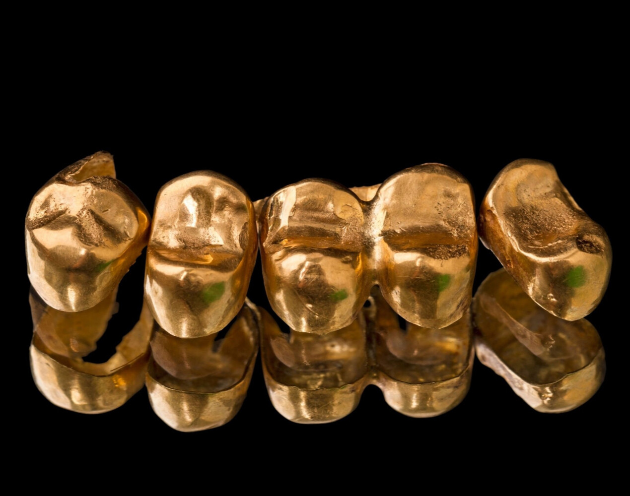 Скупка  стоматологического золота в Москве